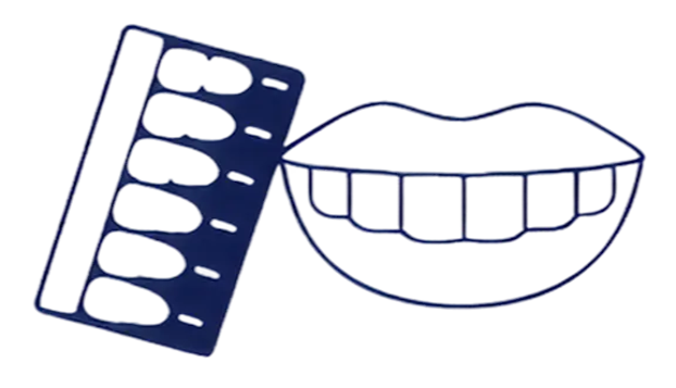 Dental impression tray next to a mouth with teeth illustration on a white background