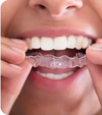 Person holding a clear dental aligner with their mouth open
