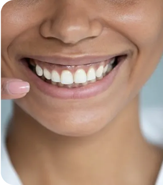 Close-up of a person's face with a smile, showing teeth.