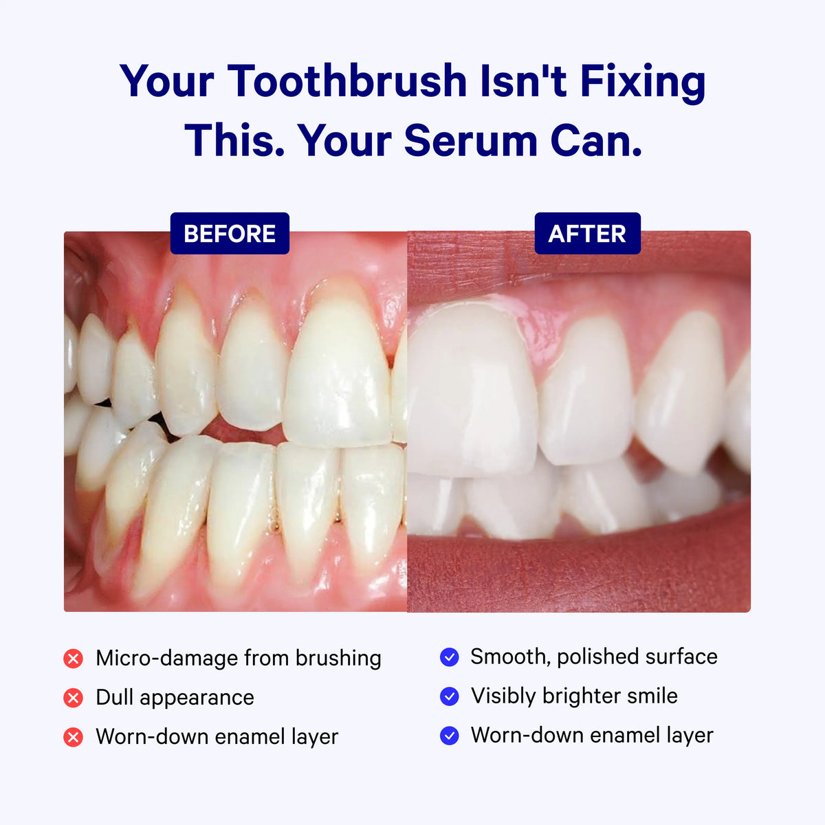 Before-and-after teeth whitening comparison with the headline 'Your Toothbrush Isn't Fixing This. Your Serum Can.